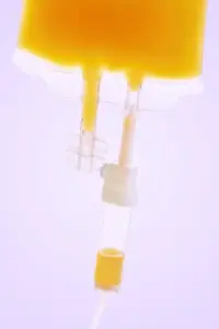 Can Filtering Your Blood Turn Back the Clock? What to Know About Therapeutic Plasma Exchange and Biological Age