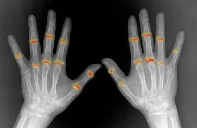 Inherent Developmental Differences Pre-Program Vulnerability to Rheumatoid Arthritis Before Birth, Study Reveals