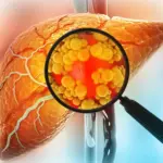 New Research Challenges the Safety of Common Sugar Substitutes, Showing Sorbitol Can Convert to Fructose-Like Compounds in the Body