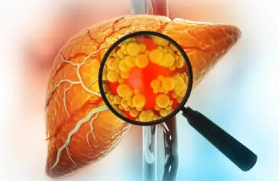 New Research Challenges the Safety of Common Sugar Substitutes, Showing Sorbitol Can Convert to Fructose-Like Compounds in the Body
